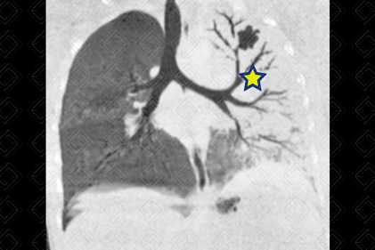 Texto alternativo para a imagem