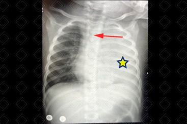 Texto alternativo para a imagem