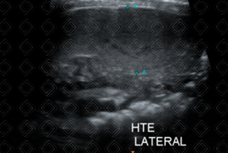 Texto alternativo para a imagem