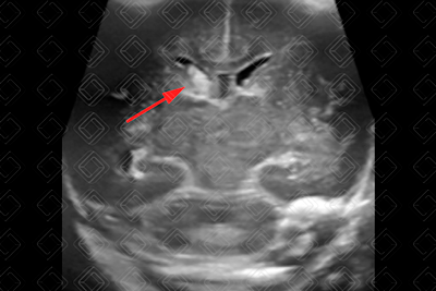 Texto alternativo para a imagem