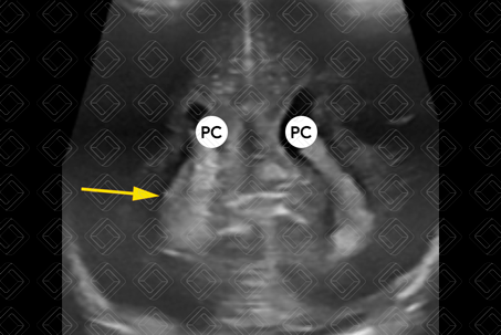 Texto alternativo para a imagem