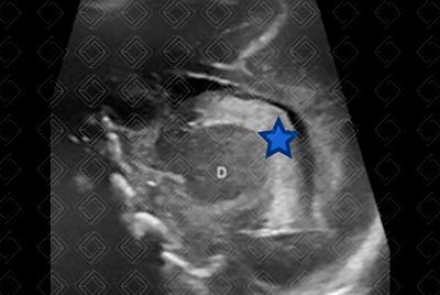 Texto alternativo para a imagem