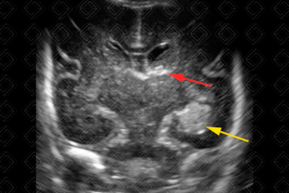 Texto alternativo para a imagem