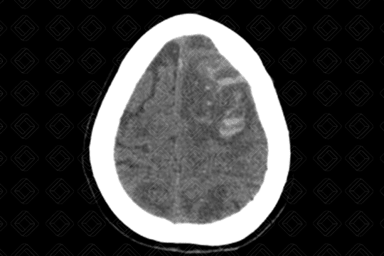 Texto alternativo para a imagem