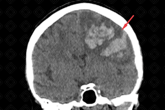 Texto alternativo para a imagem