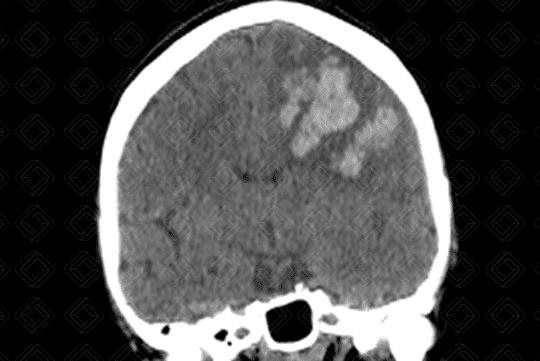 Texto alternativo para a imagem