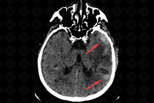 Texto alternativo para a imagem