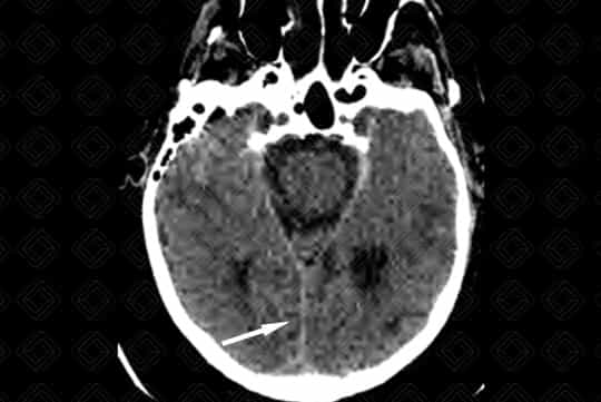 Texto alternativo para a imagem