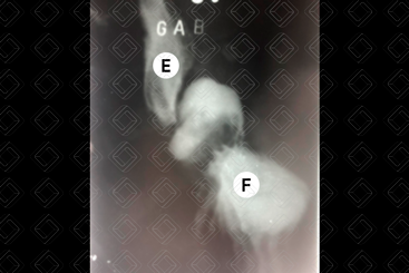 Texto alternativo para a imagem