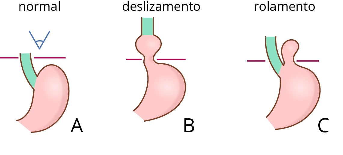 Texto alternativo para a imagem