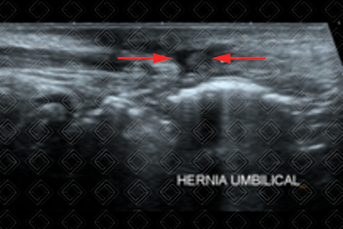 Texto alternativo para a imagem