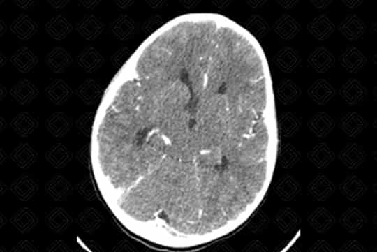 Texto alternativo para a imagem