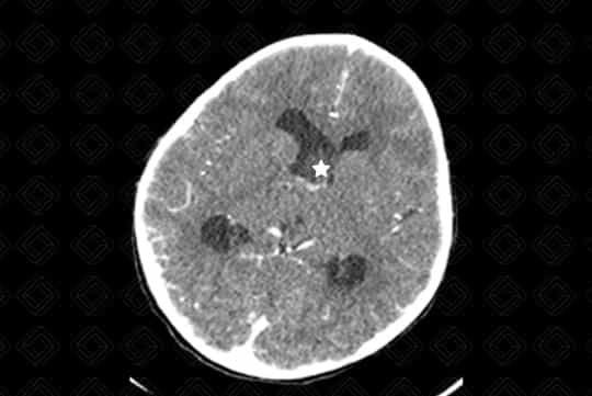 Texto alternativo para a imagem