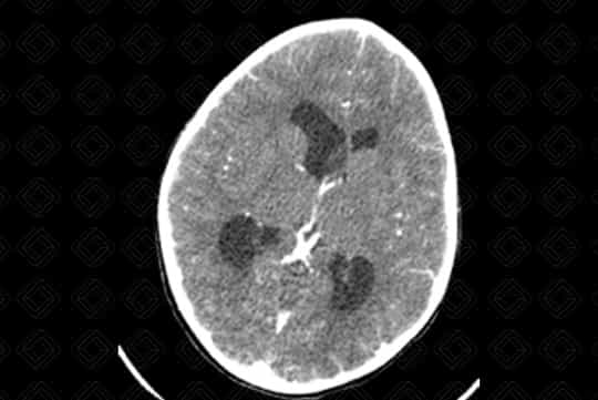 Texto alternativo para a imagem