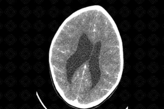 Texto alternativo para a imagem