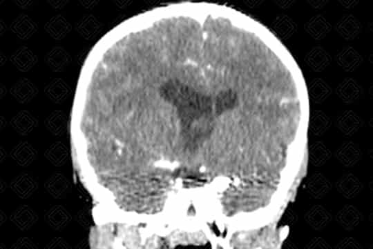 Texto alternativo para a imagem