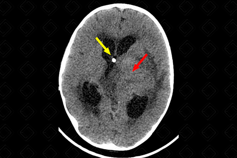 Texto alternativo para a imagem