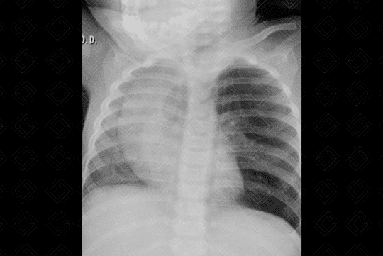 Texto alternativo para a imagem