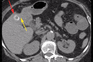 Texto alternativo para a imagem