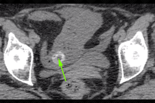 Texto alternativo para a imagem