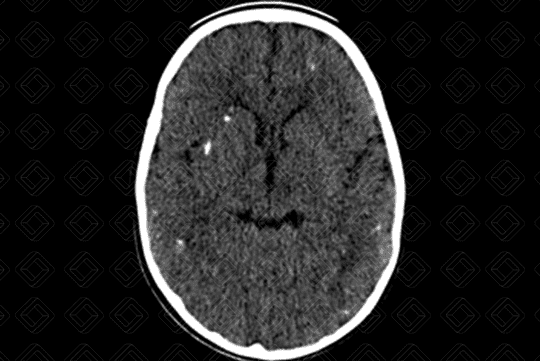 Texto alternativo para a imagem