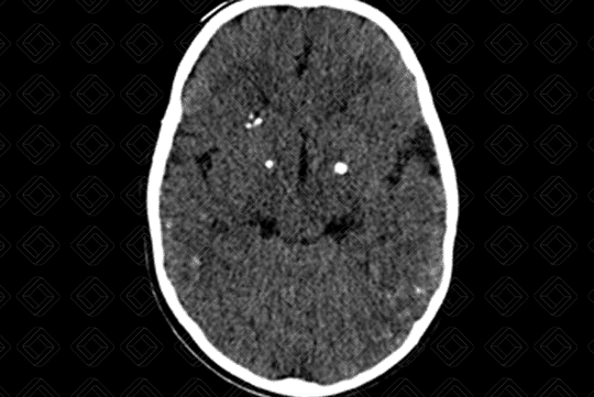 Texto alternativo para a imagem