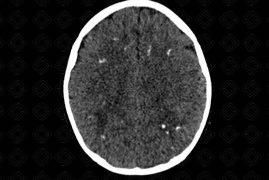 Texto alternativo para a imagem