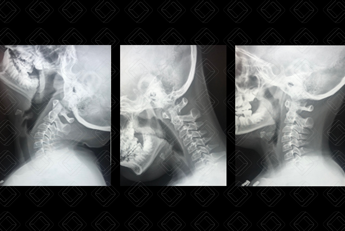 Texto alternativo para a imagem