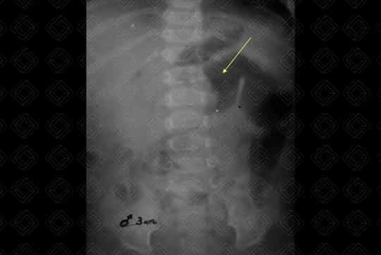 Texto alternativo para a imagem