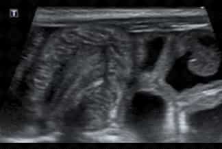 Texto alternativo para a imagem