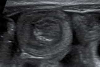 Texto alternativo para a imagem