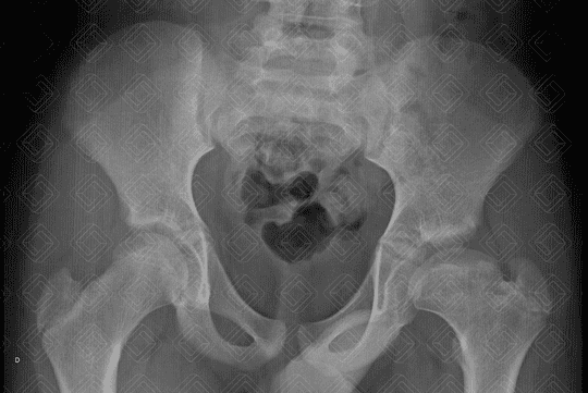 Texto alternativo para a imagem