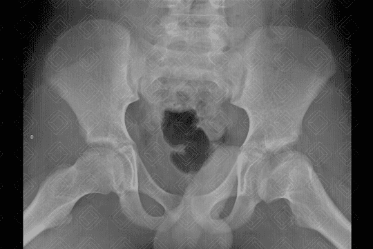 Texto alternativo para a imagem