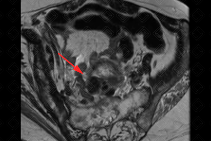 Texto alternativo para a imagem