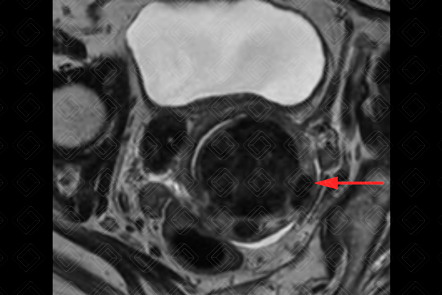 Texto alternativo para a imagem