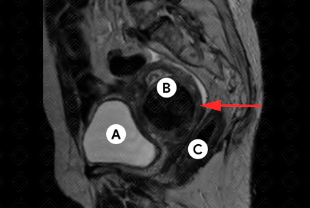 Texto alternativo para a imagem