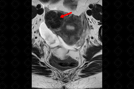 Texto alternativo para a imagem