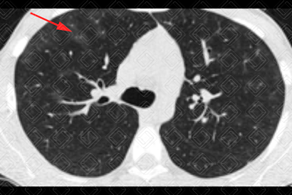 Texto alternativo para a imagem