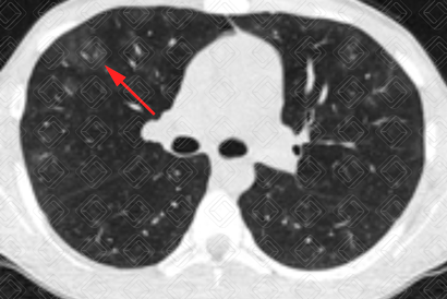 Texto alternativo para a imagem