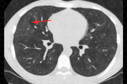 Texto alternativo para a imagem