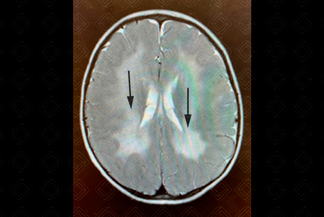 Texto alternativo para a imagem