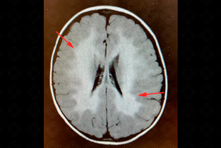 Texto alternativo para a imagem