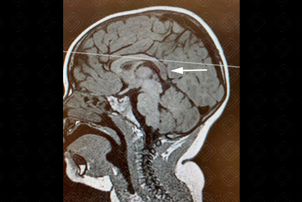 Texto alternativo para a imagem