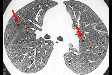 Texto alternativo para a imagem