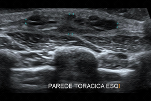 Texto alternativo para a imagem