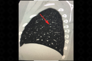 Texto alternativo para a imagem