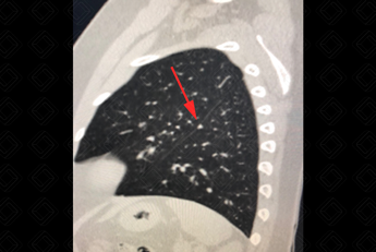 Texto alternativo para a imagem