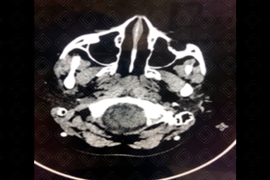 Texto alternativo para a imagem