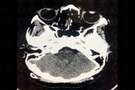 Texto alternativo para a imagem