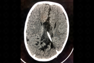 Texto alternativo para a imagem